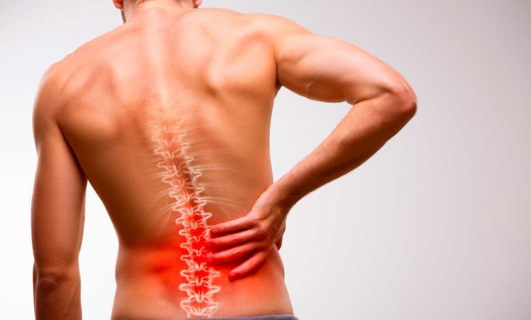 Spondilite anchilosante mal di schiena sintomi malattia