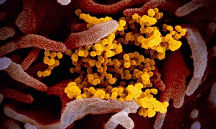 Coronavirus Burioni virologo rischio infezione virus pericoloso sars