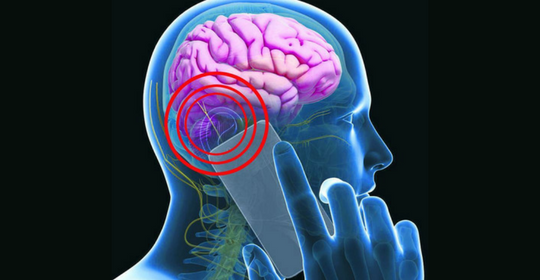 Mal Di Testa Quando Diventa Sintomo Di Un Tumore Al Cervello