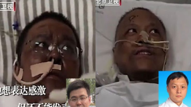 Virus medici cinesi pelle scura