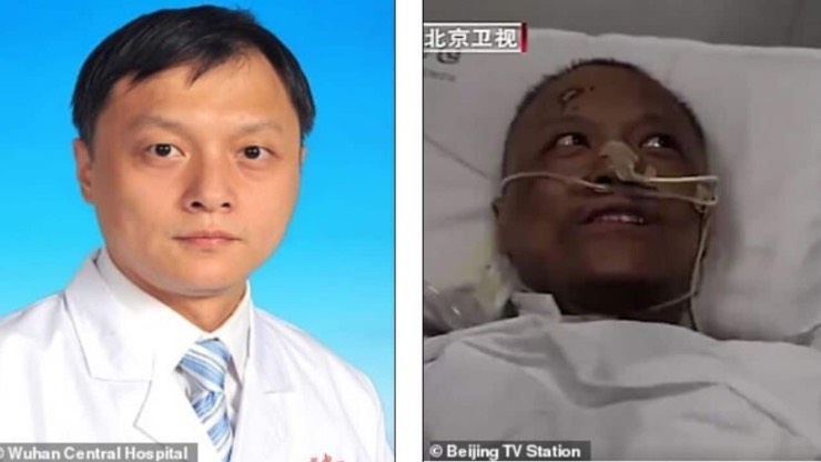 Virus medici cinesi pelle scura