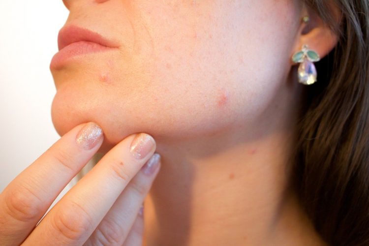 Virus e iritazioni della pelle 