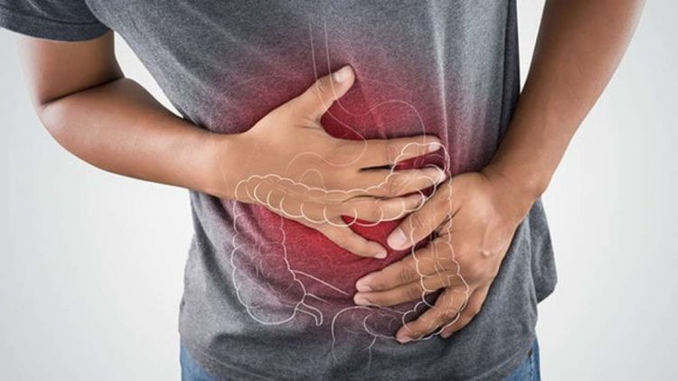 Sindrome del colon irritabile (Web)