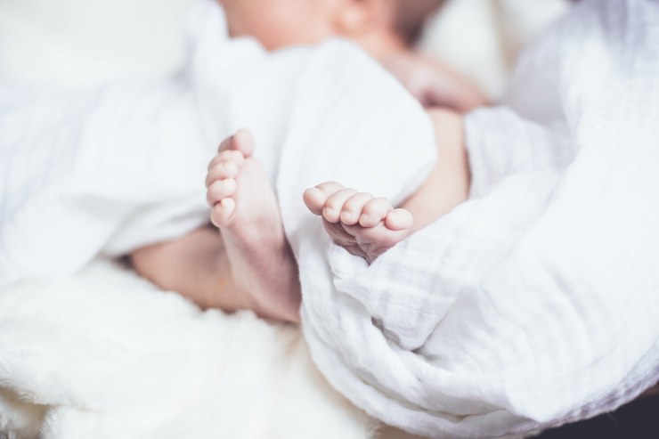 Santiago Vultaggio, il bambino con nato con due teste (Foto di Pexels da Pixabay)