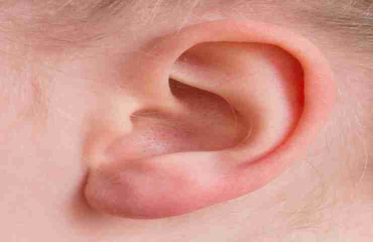 metodi per camuffare le orecchie a sventola