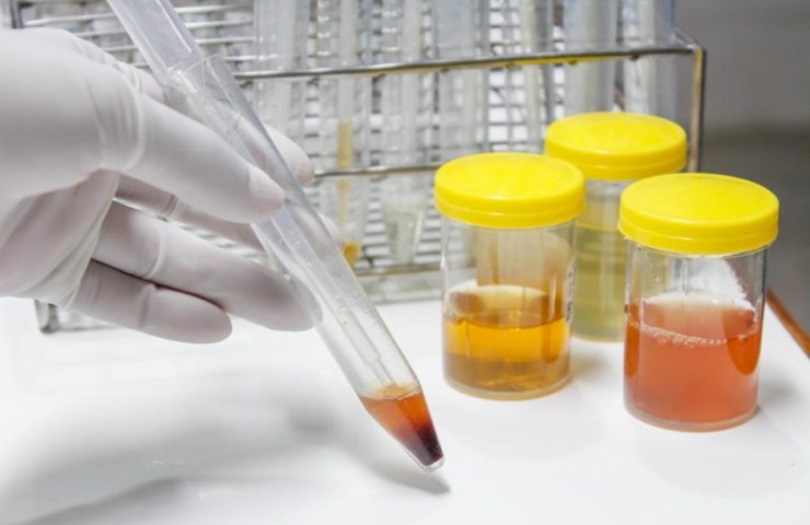 laboratorio analisi urina - foto dal web 