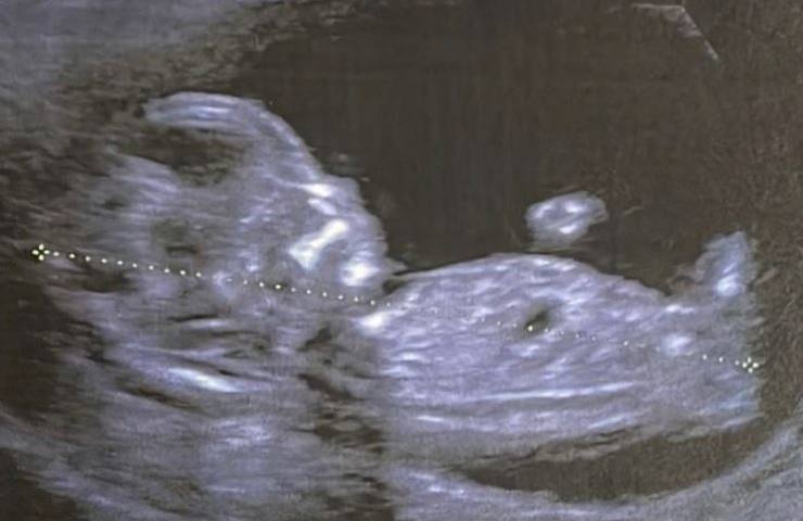 Francesca Musci svela foto feto chi è il padre