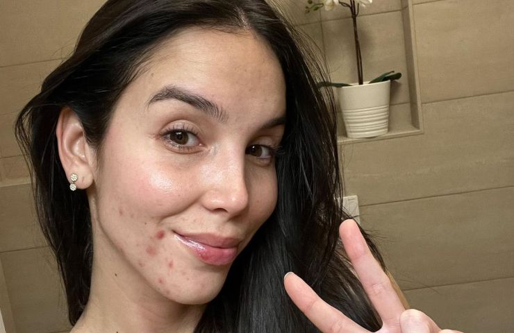 Paola Di Benedetto selfie bagno acne